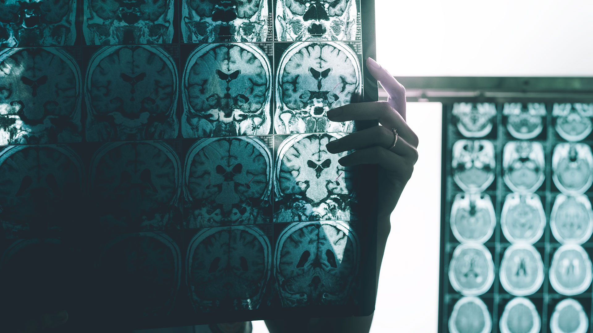 A person holding up and examining an x-ray sheet of brain scans.