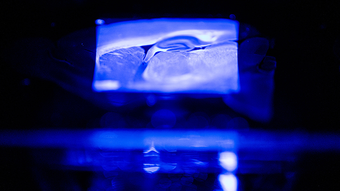 A detailed display of a tissue slide on a microscope.